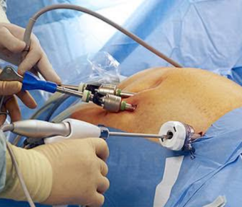 Modern diagnostic procedure equipment