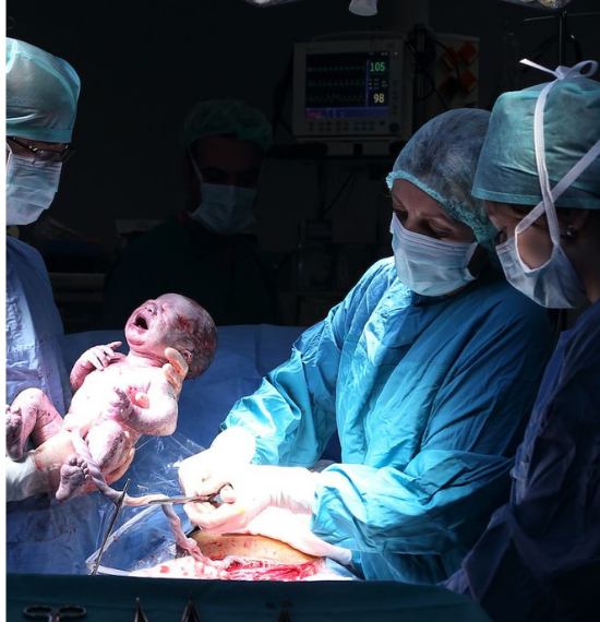 Caesarean section consultation with an obstetrician