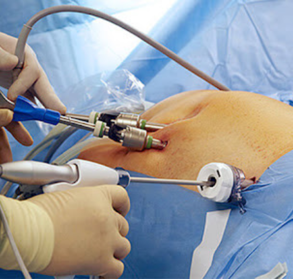 Hysteroscopy care and consultation
