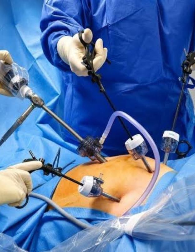 Laparoscopy consultation and pelvic health assessment