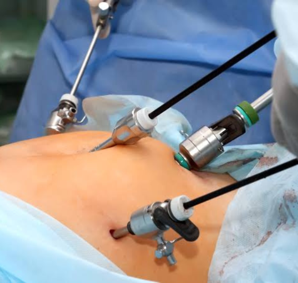 Hysterectomy care and consultation