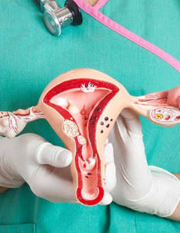 Hysterectomy consultation and pelvic health assessment